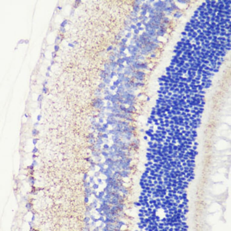 Immunohistochemistry - Anti-CRB1 Antibody (A8756) - Antibodies.com