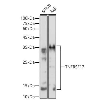 Western Blot - Anti-BCMA Antibody (A8765) - Antibodies.com