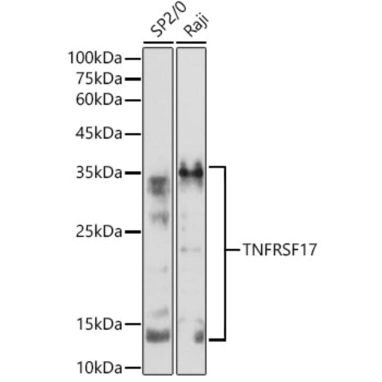 Western Blot - Anti-BCMA Antibody (A8765) - Antibodies.com