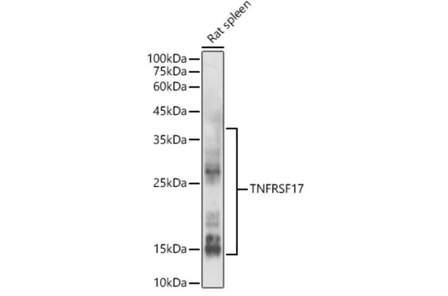 Western Blot - Anti-BCMA Antibody (A8765) - Antibodies.com