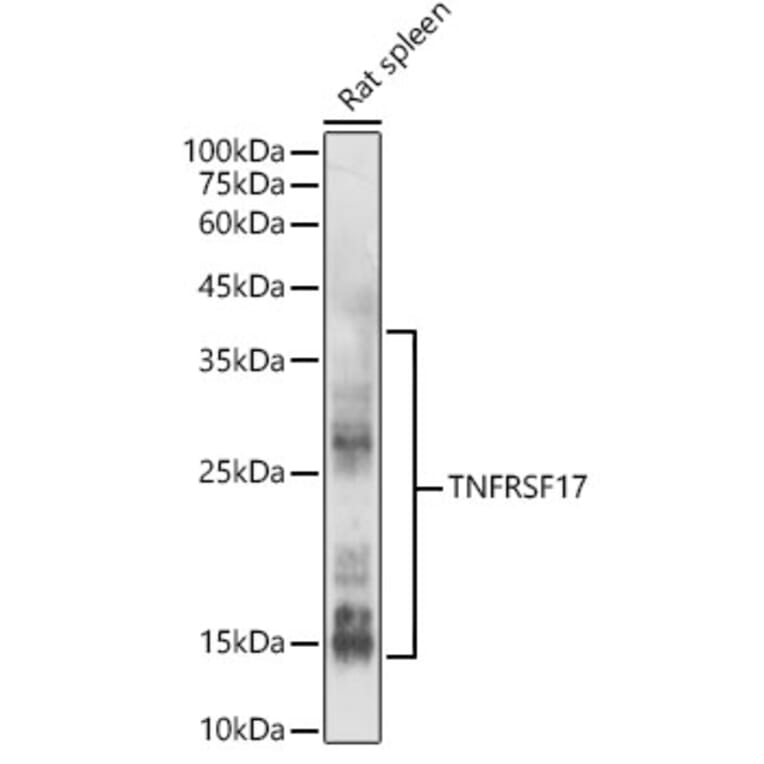 Western Blot - Anti-BCMA Antibody (A8765) - Antibodies.com