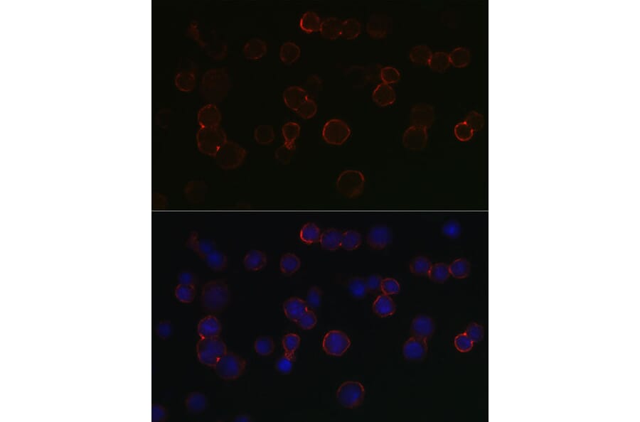 Immunofluorescence - Anti-BCMA Antibody (A8765) - Antibodies.com