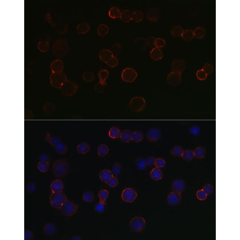 Immunofluorescence - Anti-BCMA Antibody (A8765) - Antibodies.com