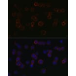 Immunofluorescence - Anti-BCMA Antibody (A8765) - Antibodies.com