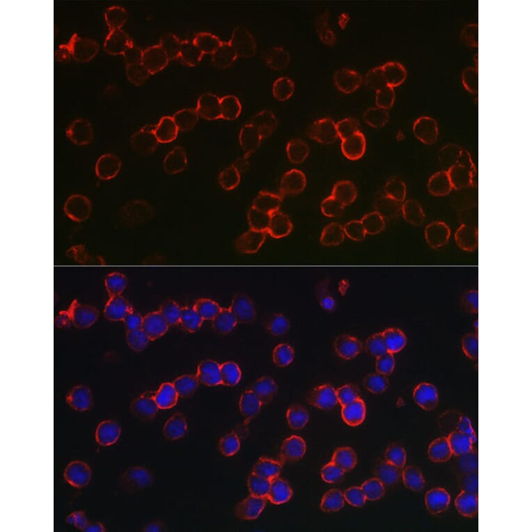 Immunofluorescence - Anti-BCMA Antibody (A8765) - Antibodies.com
