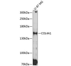 Western Blot - Anti-Collagen IV Antibody (A8766) - Antibodies.com