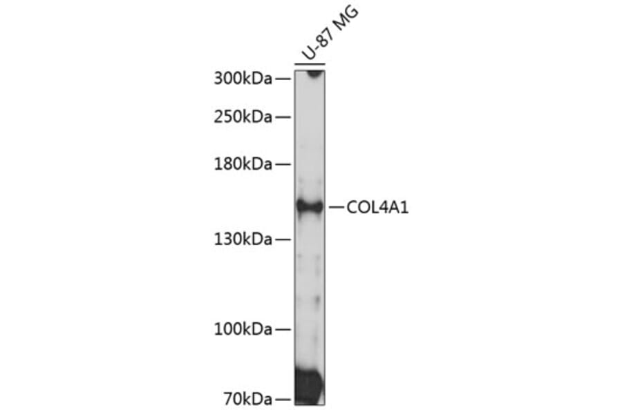 Western Blot - Anti-Collagen IV Antibody (A8766) - Antibodies.com