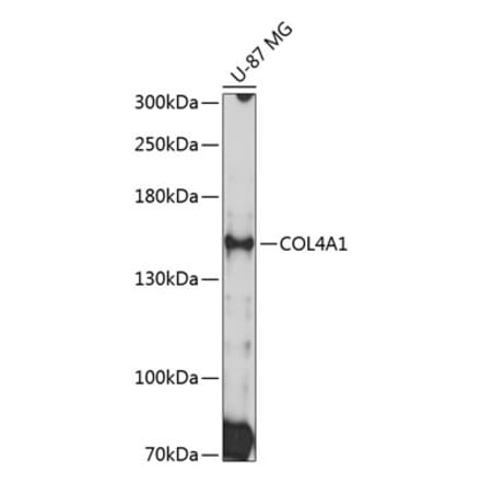 Western Blot - Anti-Collagen IV Antibody (A8766) - Antibodies.com
