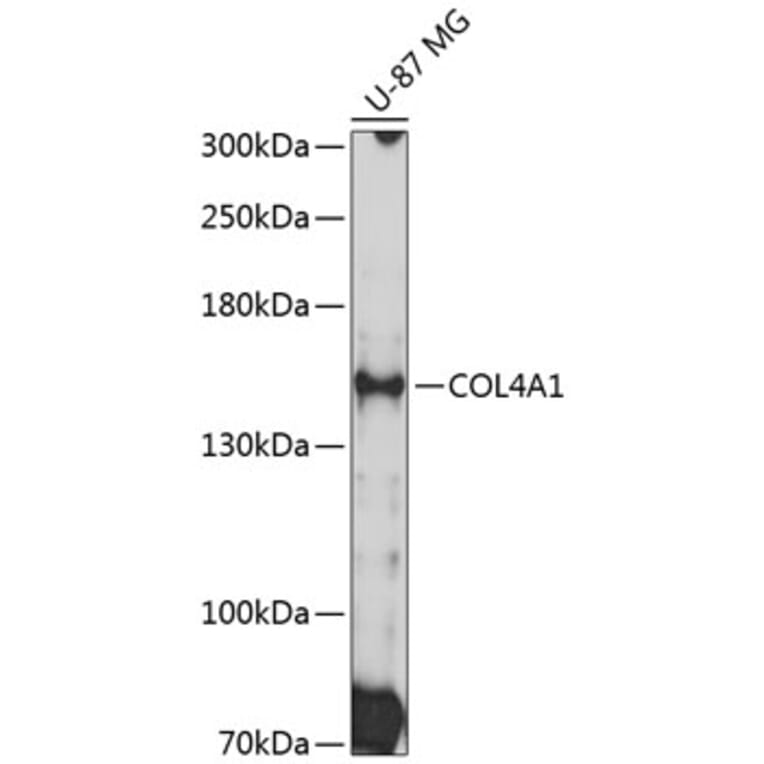 Western Blot - Anti-Collagen IV Antibody (A8766) - Antibodies.com