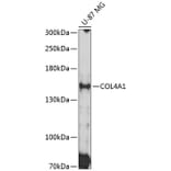 Western Blot - Anti-Collagen IV Antibody (A8766) - Antibodies.com