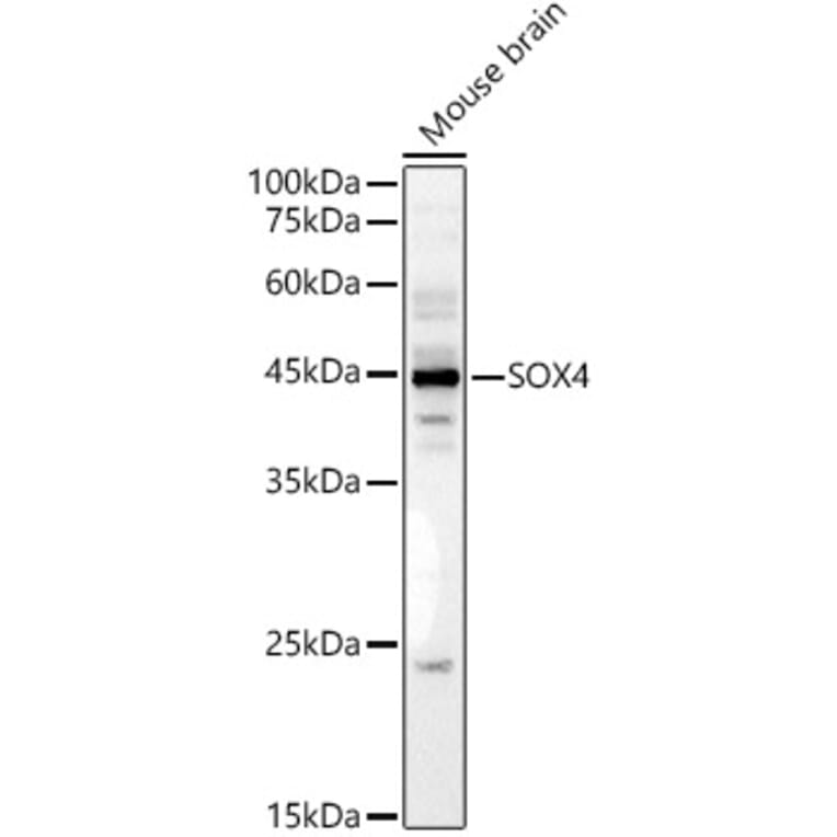 Western Blot - Anti-SOX4 Antibody (A8773) - Antibodies.com