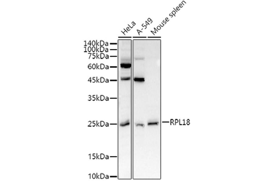 Western Blot - Anti-RPL18 Antibody (A8776) - Antibodies.com