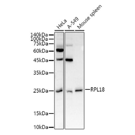 Western Blot - Anti-RPL18 Antibody (A8776) - Antibodies.com