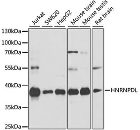 Western Blot - Anti-HNRPDL Antibody (A8777) - Antibodies.com