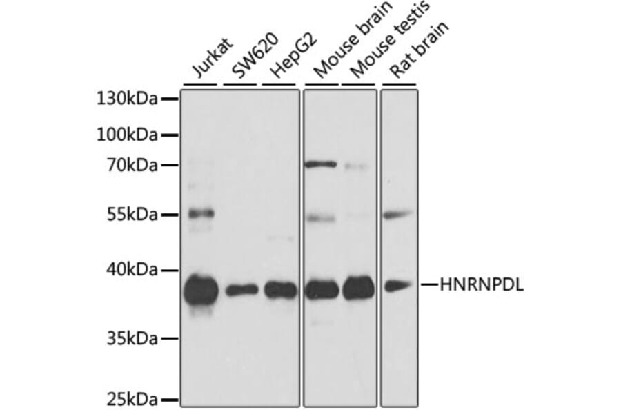 Western Blot - Anti-HNRPDL Antibody (A8777) - Antibodies.com