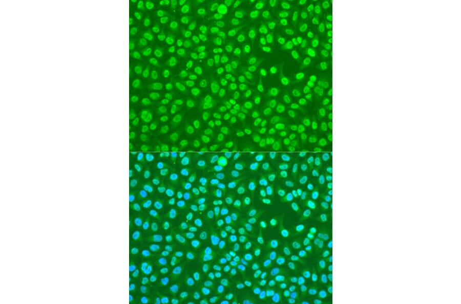 Immunofluorescence - Anti-HNRPDL Antibody (A8777) - Antibodies.com