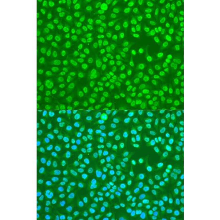 Immunofluorescence - Anti-HNRPDL Antibody (A8777) - Antibodies.com