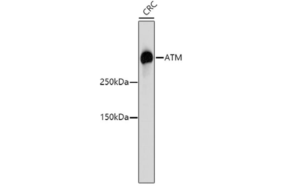 Western Blot - Anti-ATM Antibody (A10745) - Antibodies.com