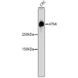 Western Blot - Anti-ATM Antibody (A10745) - Antibodies.com