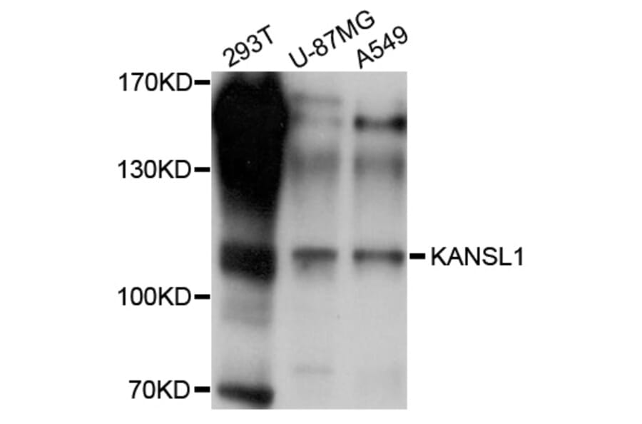 Western Blot - Anti-KANSL1 Antibody (A10755) - Antibodies.com