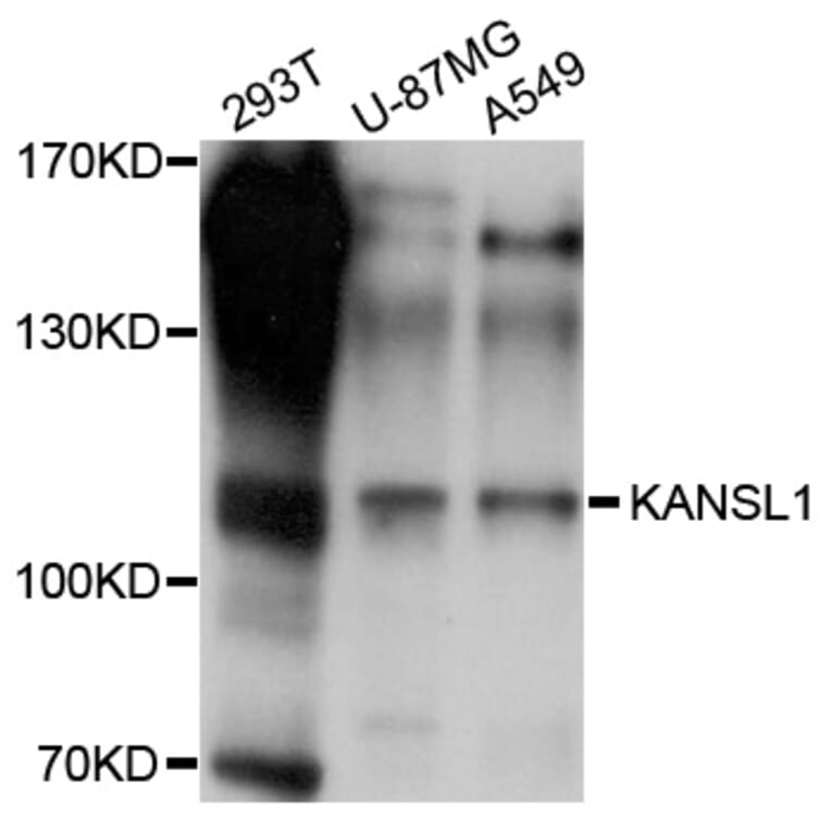 Western Blot - Anti-KANSL1 Antibody (A10755) - Antibodies.com
