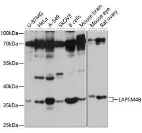 Western Blot - Anti-LAPTM4B Antibody (A8793) - Antibodies.com