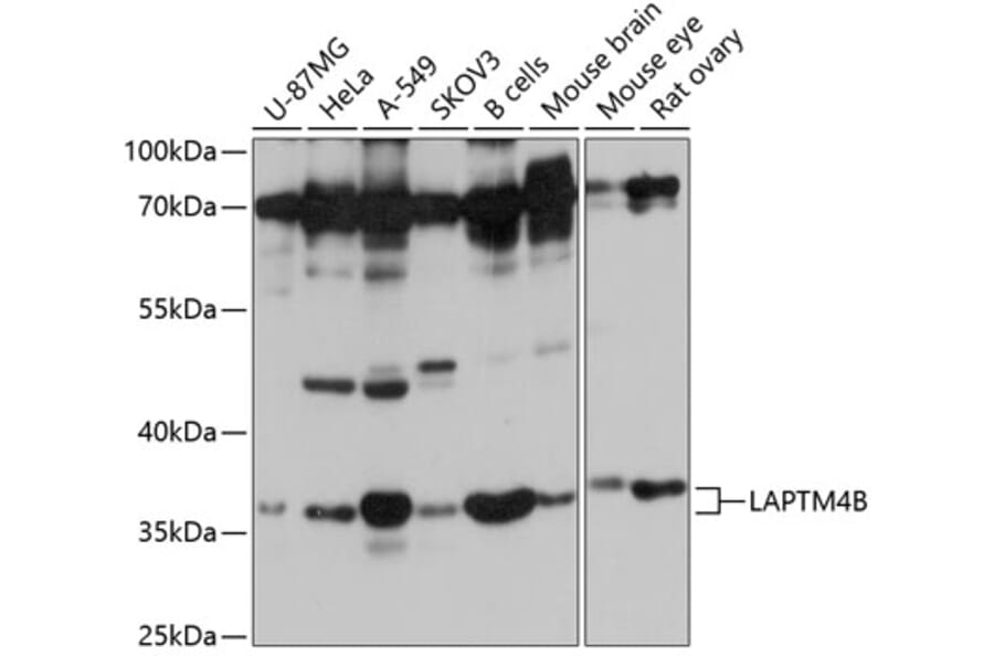 Western Blot - Anti-LAPTM4B Antibody (A8793) - Antibodies.com