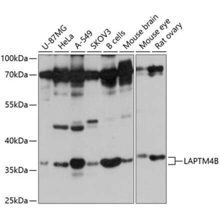 Western Blot - Anti-LAPTM4B Antibody (A8793) - Antibodies.com