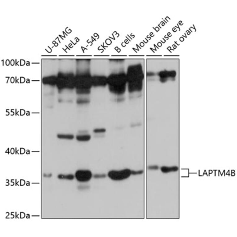 Western Blot - Anti-LAPTM4B Antibody (A8793) - Antibodies.com
