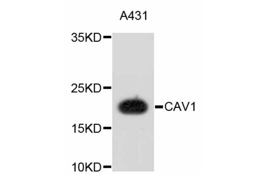 Western Blot - Anti-CAV1 Antibody (A10778) - Antibodies.com