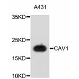 Western Blot - Anti-CAV1 Antibody (A10778) - Antibodies.com
