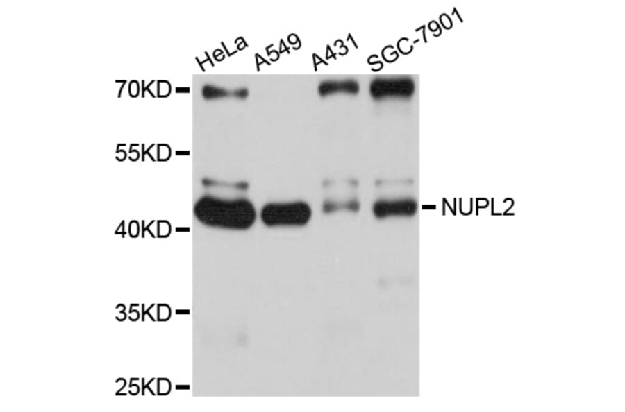 Western Blot - Anti-NUPL2 Antibody (A10779) - Antibodies.com