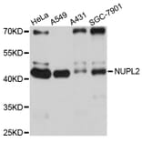 Western Blot - Anti-NUPL2 Antibody (A10779) - Antibodies.com