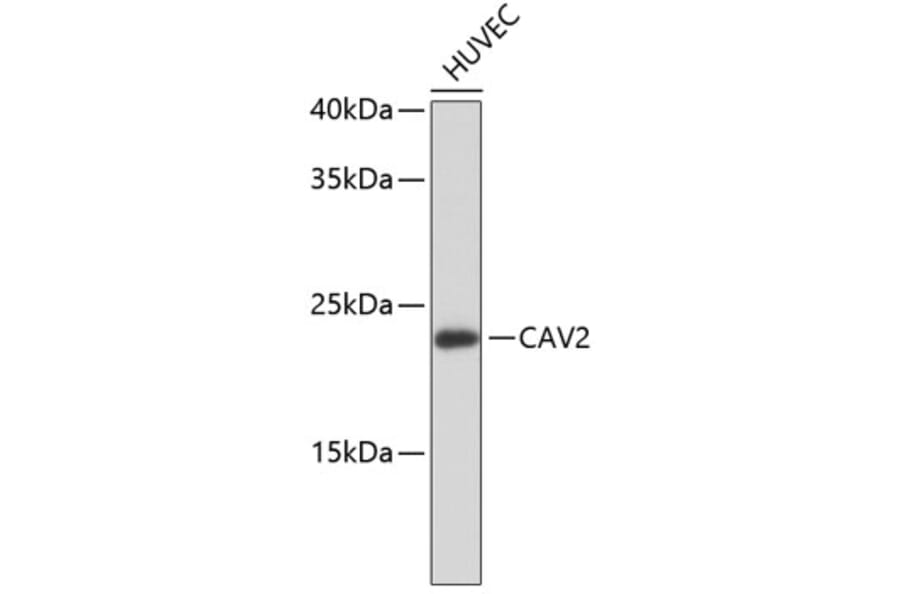 Western Blot - Anti-CAV2 Antibody (A10780) - Antibodies.com