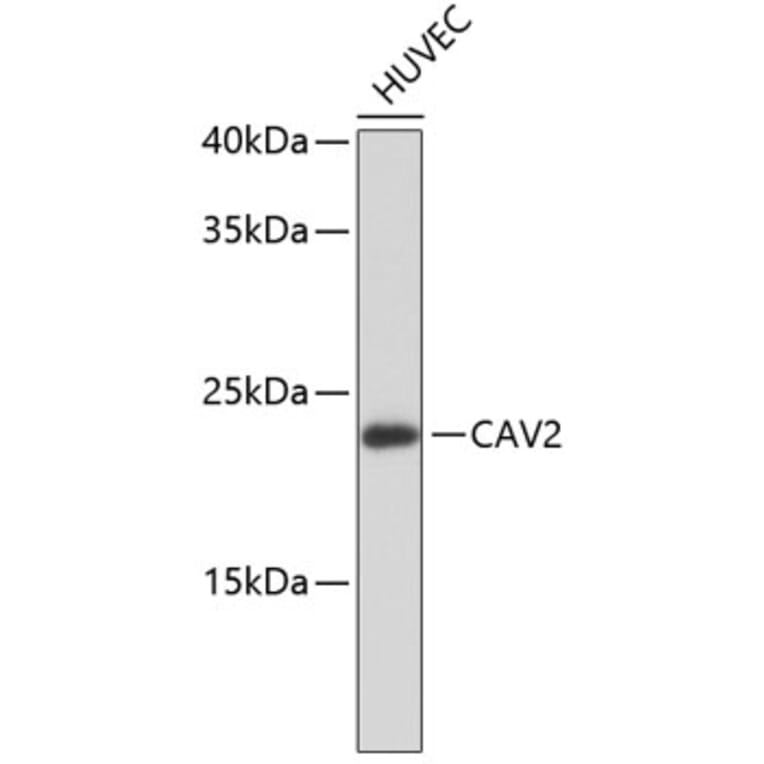 Western Blot - Anti-CAV2 Antibody (A10780) - Antibodies.com
