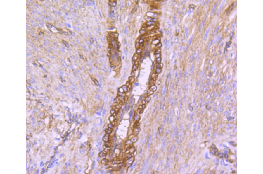 Immunohistochemistry - Anti-CAV2 Antibody (A10780) - Antibodies.com