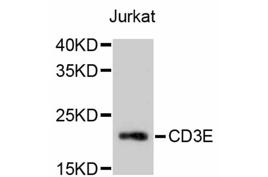 Western Blot - Anti-CD3E Antibody (A10786) - Antibodies.com