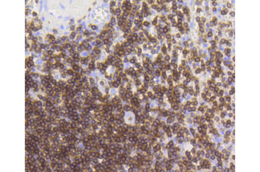 Immunohistochemistry - Anti-CD3E Antibody (A10786) - Antibodies.com
