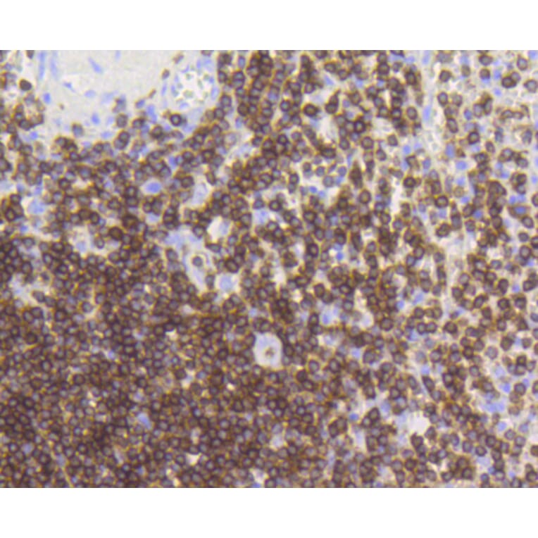 Immunohistochemistry - Anti-CD3E Antibody (A10786) - Antibodies.com
