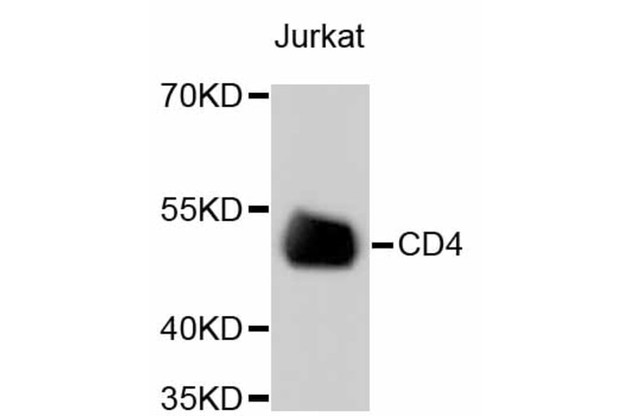 Western Blot - Anti-CD4 Antibody (A10787) - Antibodies.com