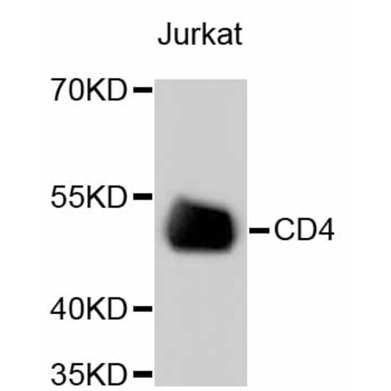 Western Blot - Anti-CD4 Antibody (A10787) - Antibodies.com