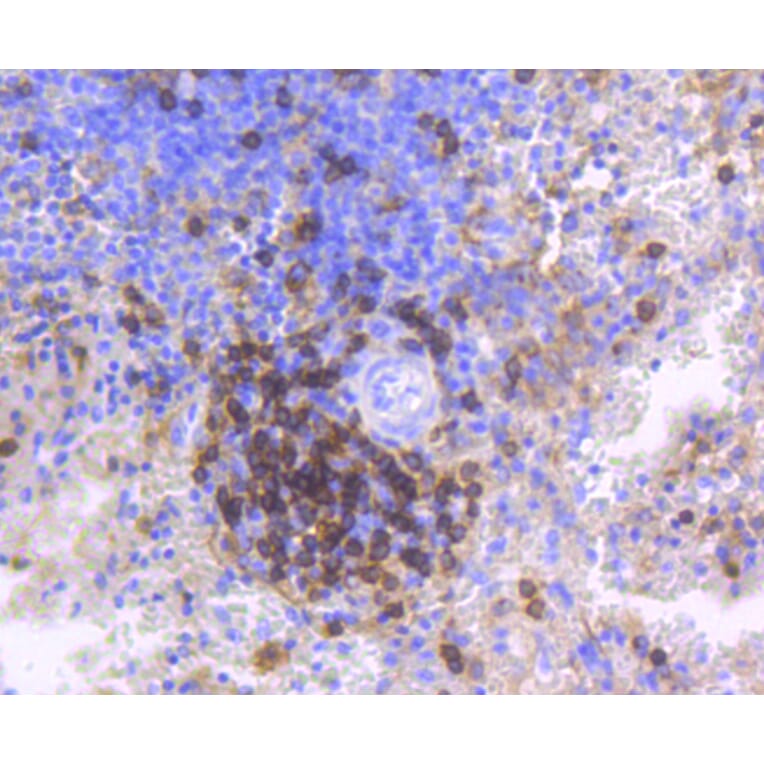 Immunohistochemistry - Anti-CD4 Antibody (A10787) - Antibodies.com