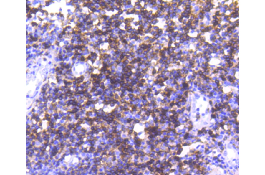Immunohistochemistry - Anti-CD4 Antibody (A10787) - Antibodies.com