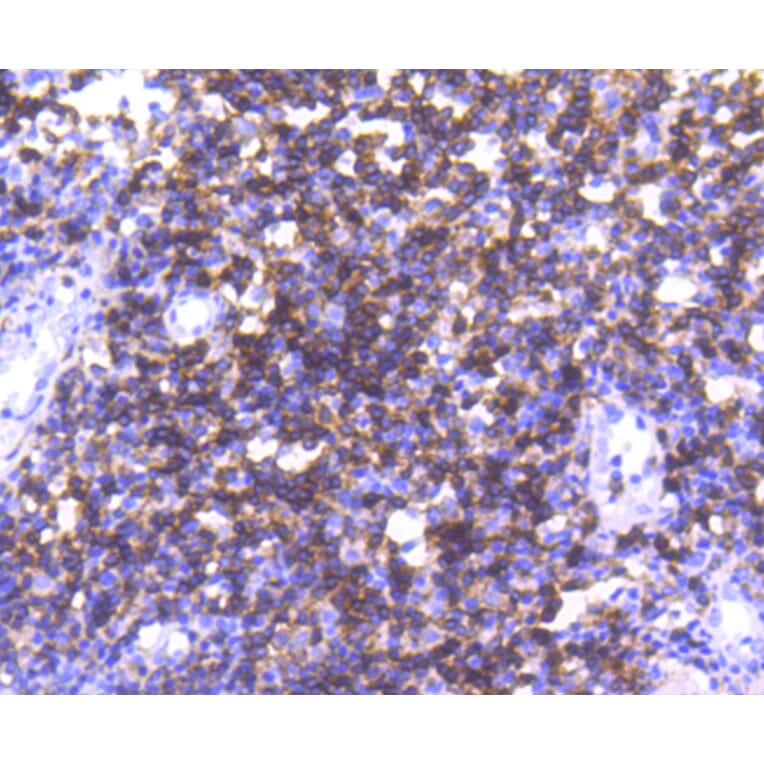 Immunohistochemistry - Anti-CD4 Antibody (A10787) - Antibodies.com