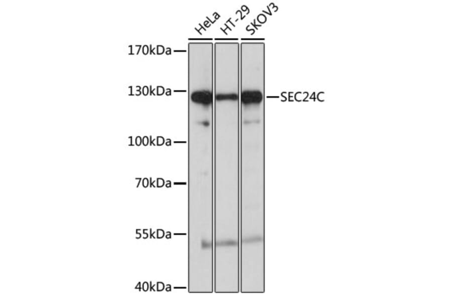 Western Blot - Anti-Sec24C Antibody (A8802) - Antibodies.com
