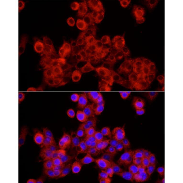 Immunofluorescence - Anti-Sec24C Antibody (A8802) - Antibodies.com
