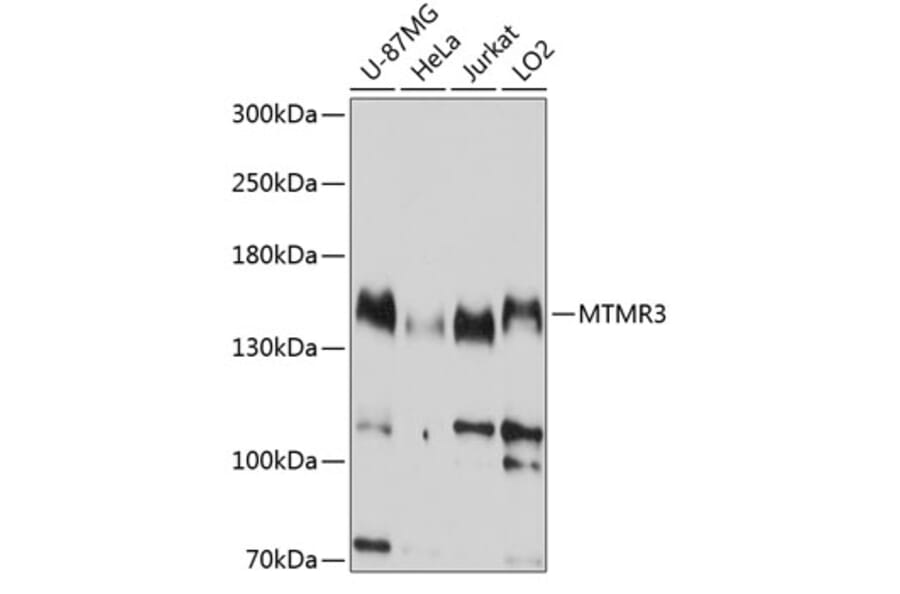 Western Blot - Anti-MTMR3 Antibody (A8806) - Antibodies.com