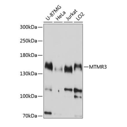 Western Blot - Anti-MTMR3 Antibody (A8806) - Antibodies.com