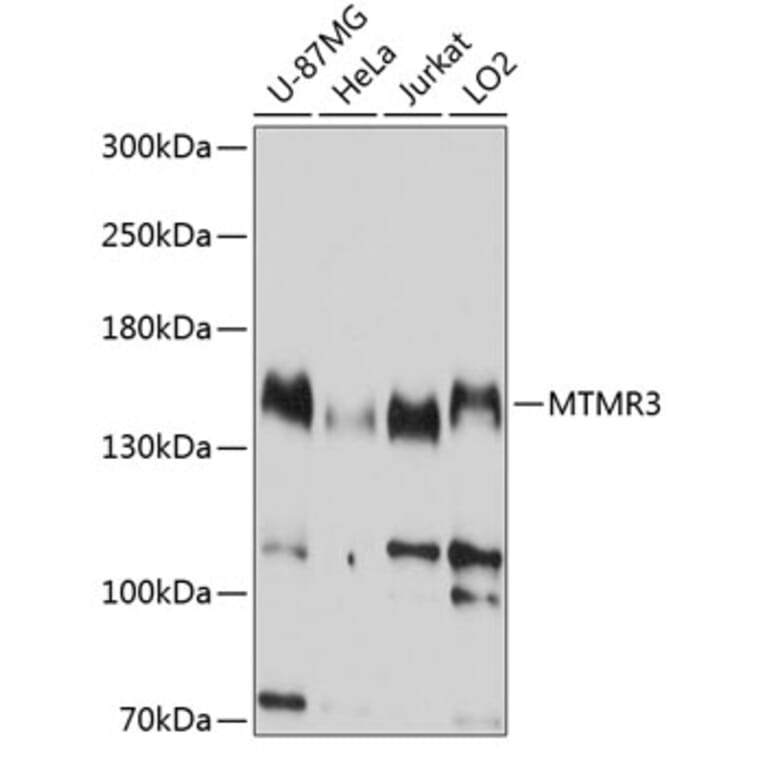 Western Blot - Anti-MTMR3 Antibody (A8806) - Antibodies.com