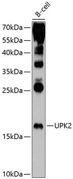 UPK2 Antibody (21149-1-AP) Proteintech, 57% OFF